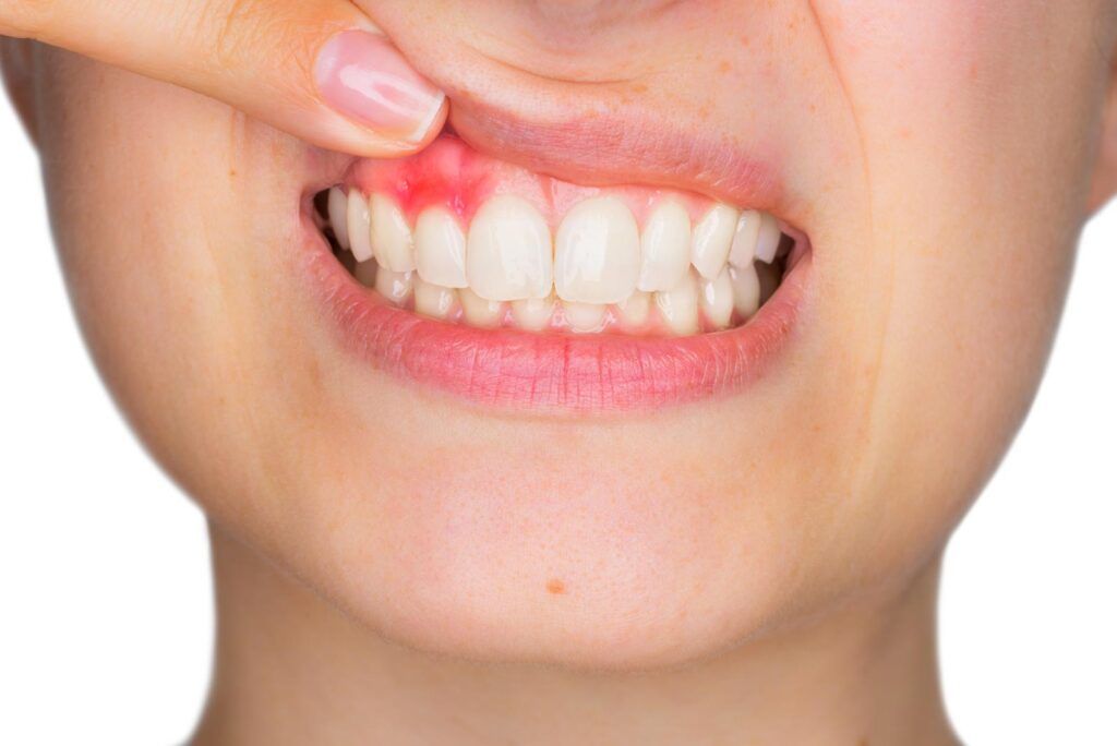 Clinique Dentaire - Traitement : Parodontologie